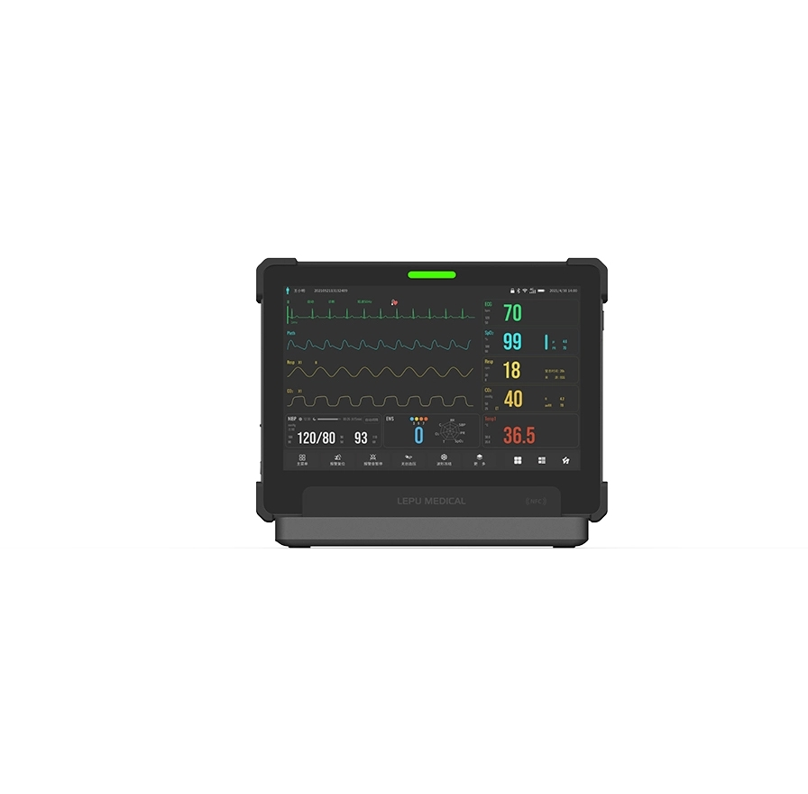 aiview vx patient monitor 1